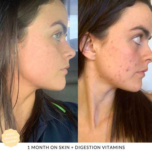 Skin + Digestion Twin Pack - 6 MONTH SUPPLY
