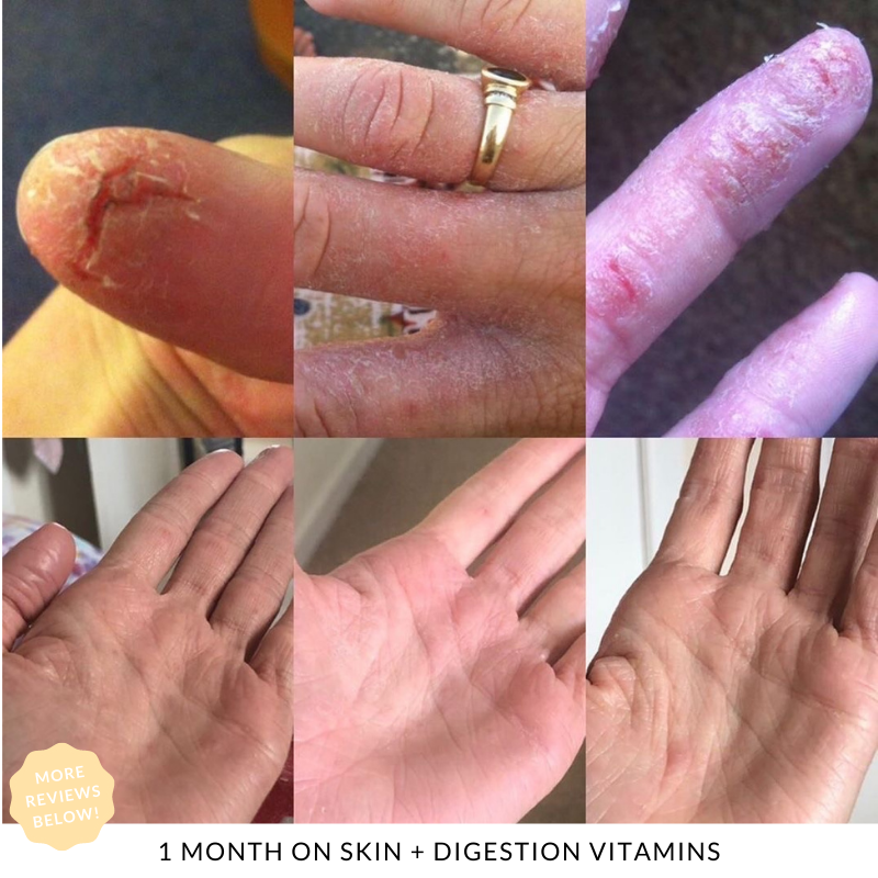 Skin + Digestion Formula - 1 Month Supply